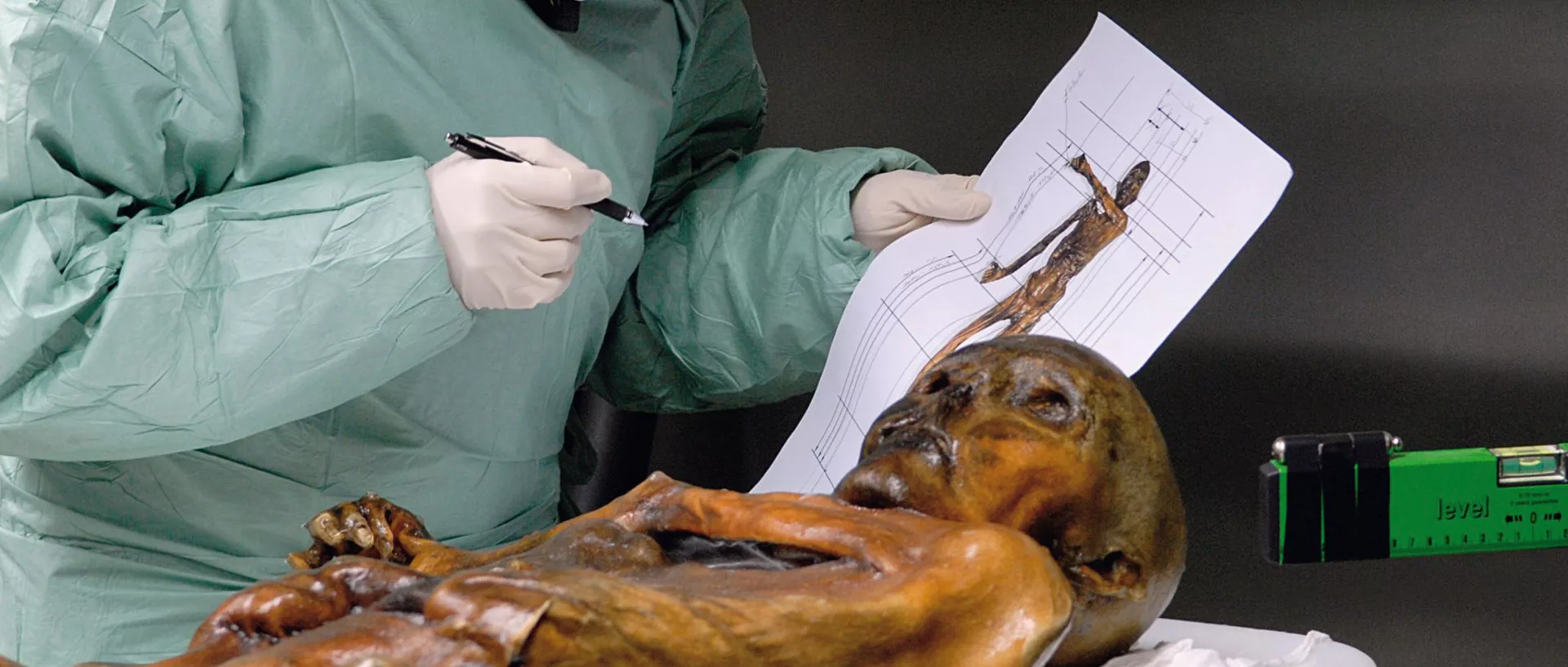 Die Mumie Ötzi auf einem Untersuchungstisch