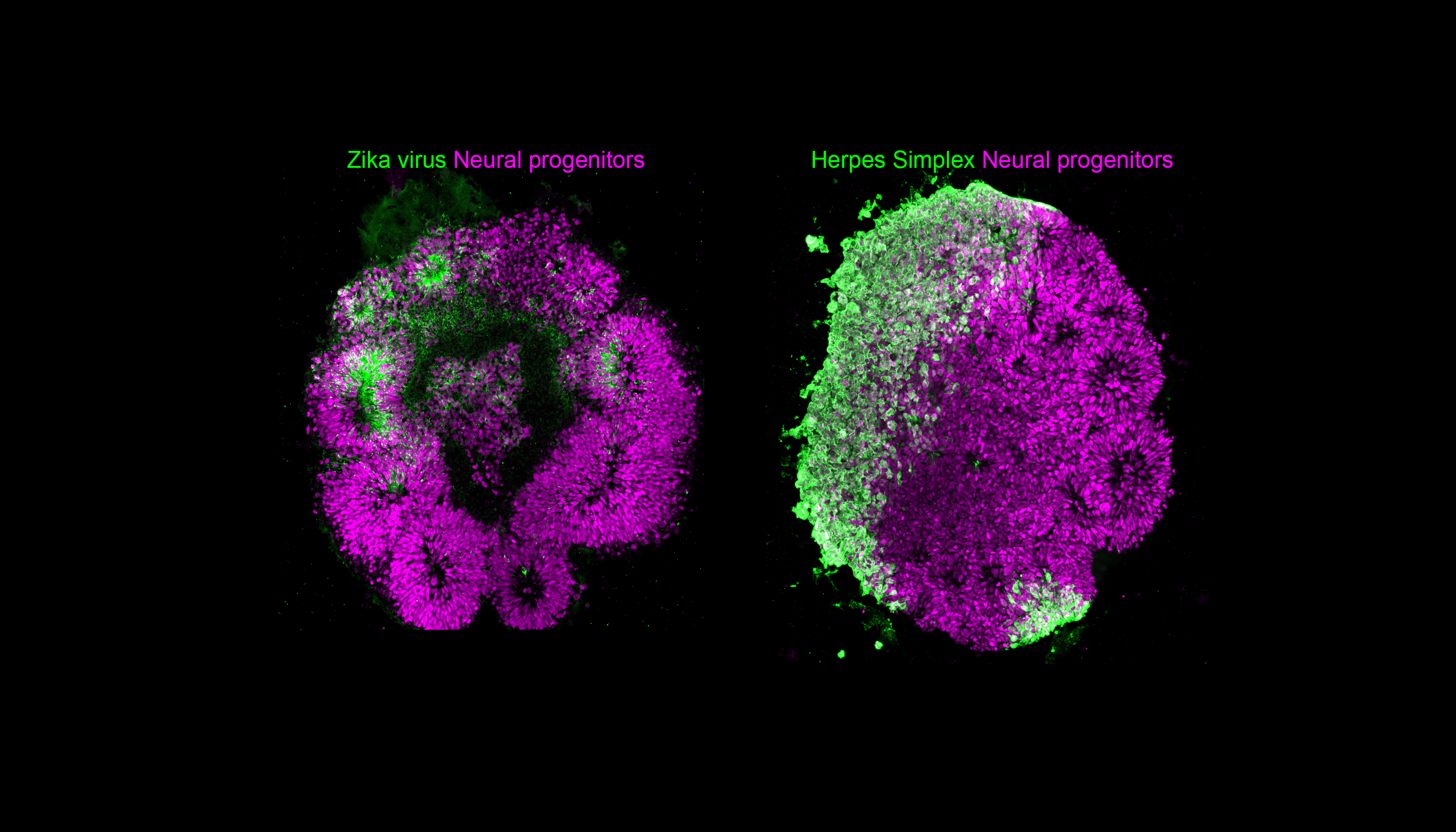 Organoids. Вирус Зика что это за вирус. Lab-grown Human Brain organoids.