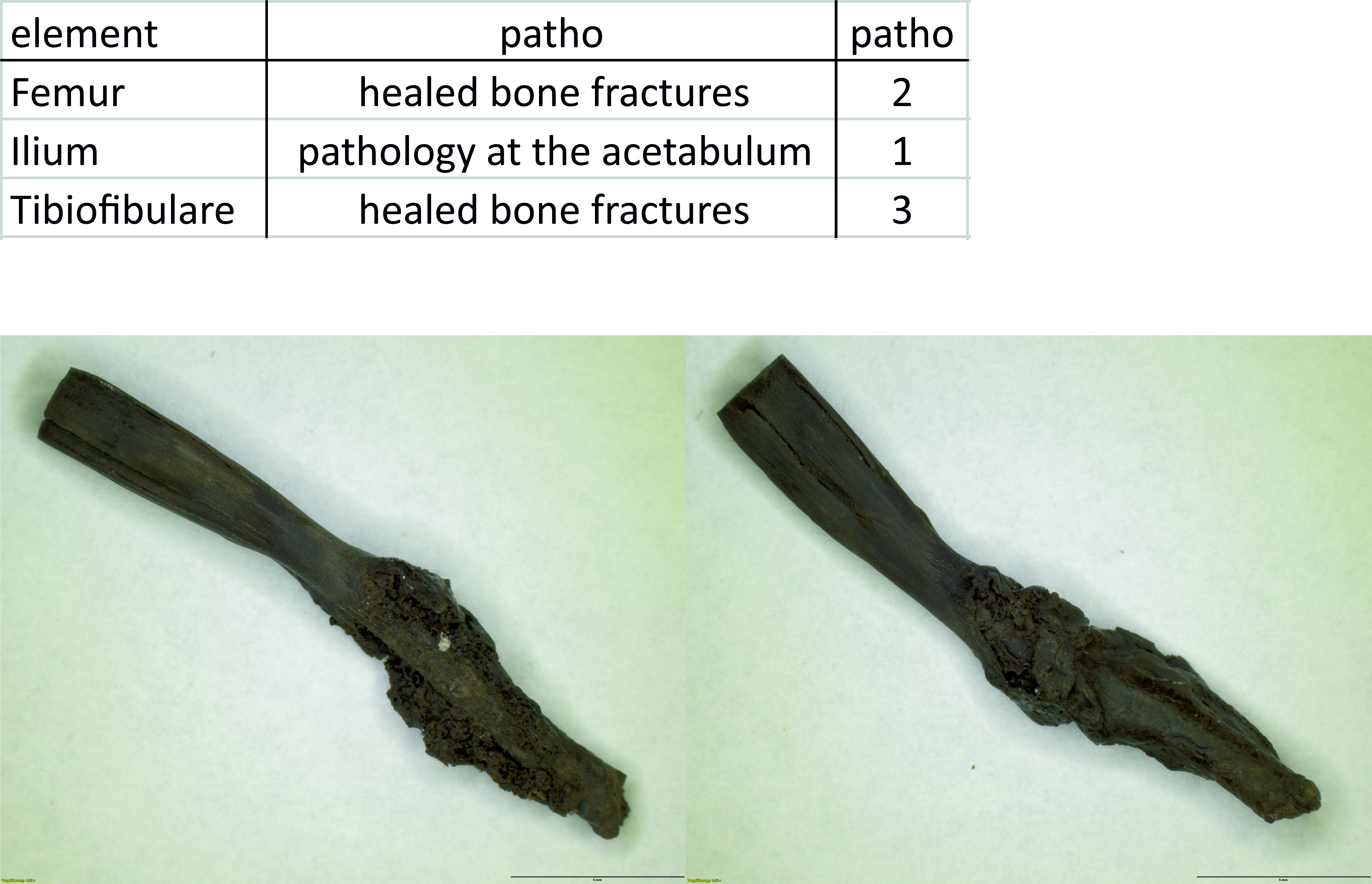 Verteilung der Pathologien an Froschknochen aus Mooskirchen am Mondsee, abgebildet ist ein Tibiofibulare mit verheiltem Bruch