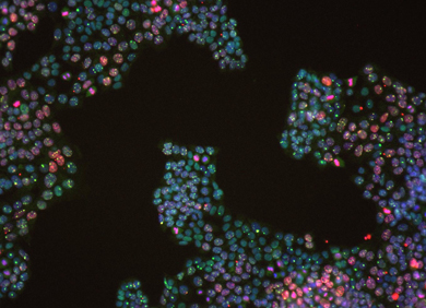 Zellen mit doppeltem Gendefekt (∆FANCC∆BLM) bei der Reparatur künstlich zugefügter DNA Schäden © Michelle Owusu/CeMM  