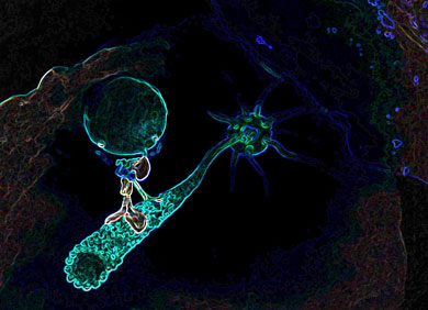 Künstlerische Darstellung des retrograden Vesikeltransports Richtung Immunsynapse, ein RASGRP1 abhängiger Prozess. © CeMM/Tatjana Hirschmugl   