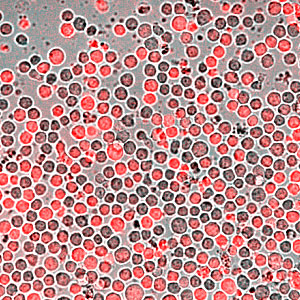 Chronische myeloische Leukämie – Zellen (KBM-7) mit rot fluoreszierendem Reportergen. ©CeMM Research Center for Molecular Medicine of the Austrian Academy of Science