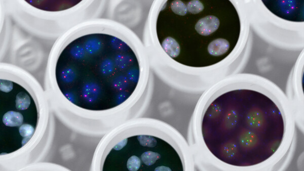 As they develop, cancer cells undergo certain changes that lead to uncontrolled growth. This is an Achilles heel that researchers want to use for drug discovery. As they develop, cancer cells undergo certain changes that lead to uncontrolled growth. This is an Achilles heel that researchers want to use for drug discovery.