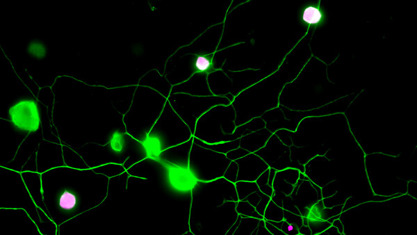 Visualisierung von Schmerz: Grüne Nervenbahnen vor einem schwarzen Hintergrund