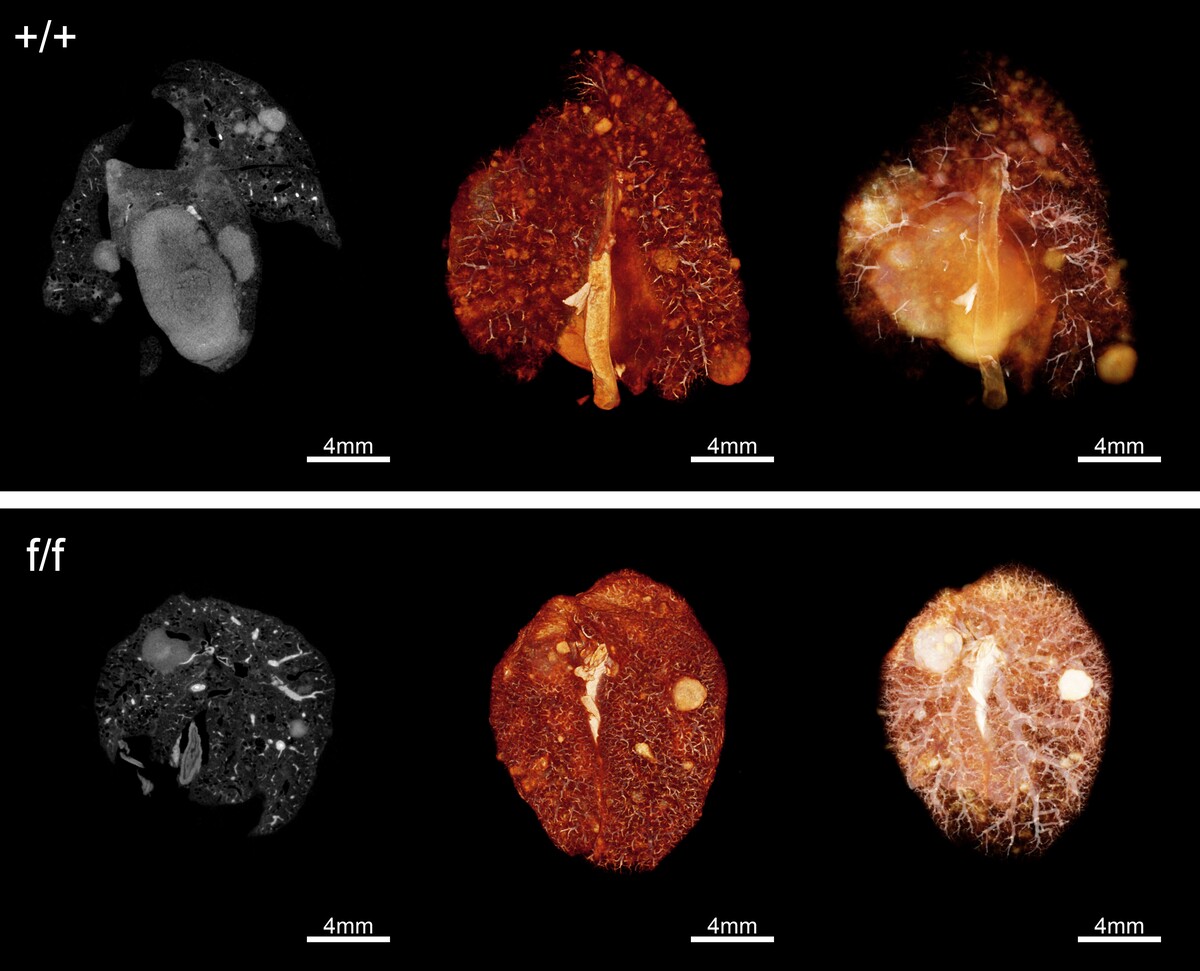 MicroCT image, which shows normal lung tumors in the upper panel. The lower panel shows lung tumors after RANK pathway inhibition. (c)IMBA