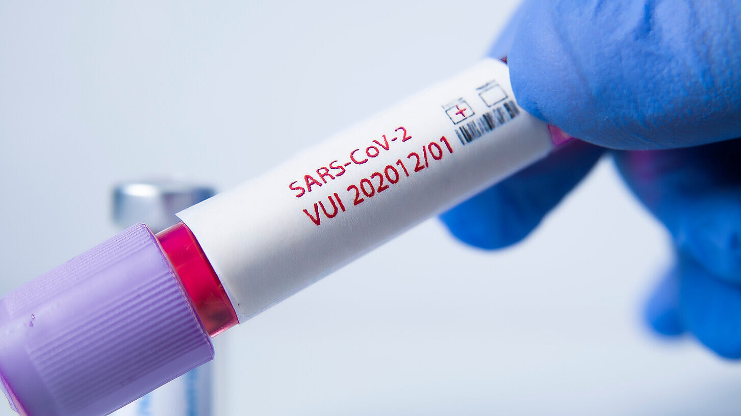VUI-202012/01 (B. 1.1.7-Linie) wird eine neue Coronavirus-Variante genannt, die erstmalig in Großbritanniens festgestellt wurde. Sie soll um bis zu 70 Prozent ansteckender sein als die bisher bekannte Form. VUI-202012/01 (B. 1.1.7-Linie) wird eine neue Coronavirus-Variante genannt, die erstmalig in Großbritanniens festgestellt wurde. Sie soll um bis zu 70 Prozent ansteckender sein als die bisher bekannte Form.