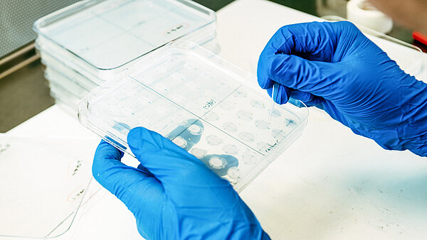 Zwei Hände in Gummi-Handschuhen halten eine durchsichtige Tafel mit Gen-Proben